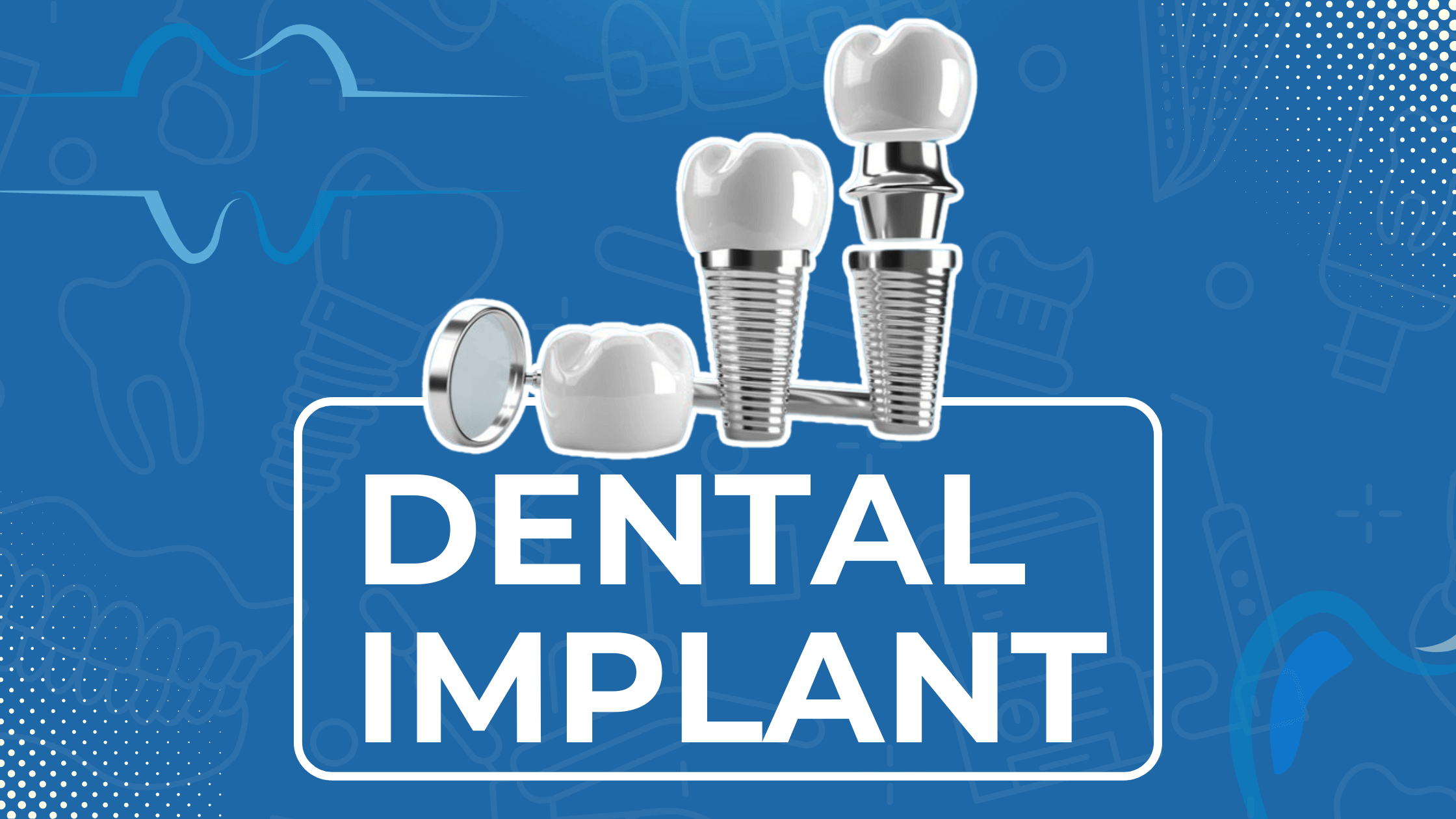 Best Dental Implant Service in Jaipur at Best Price