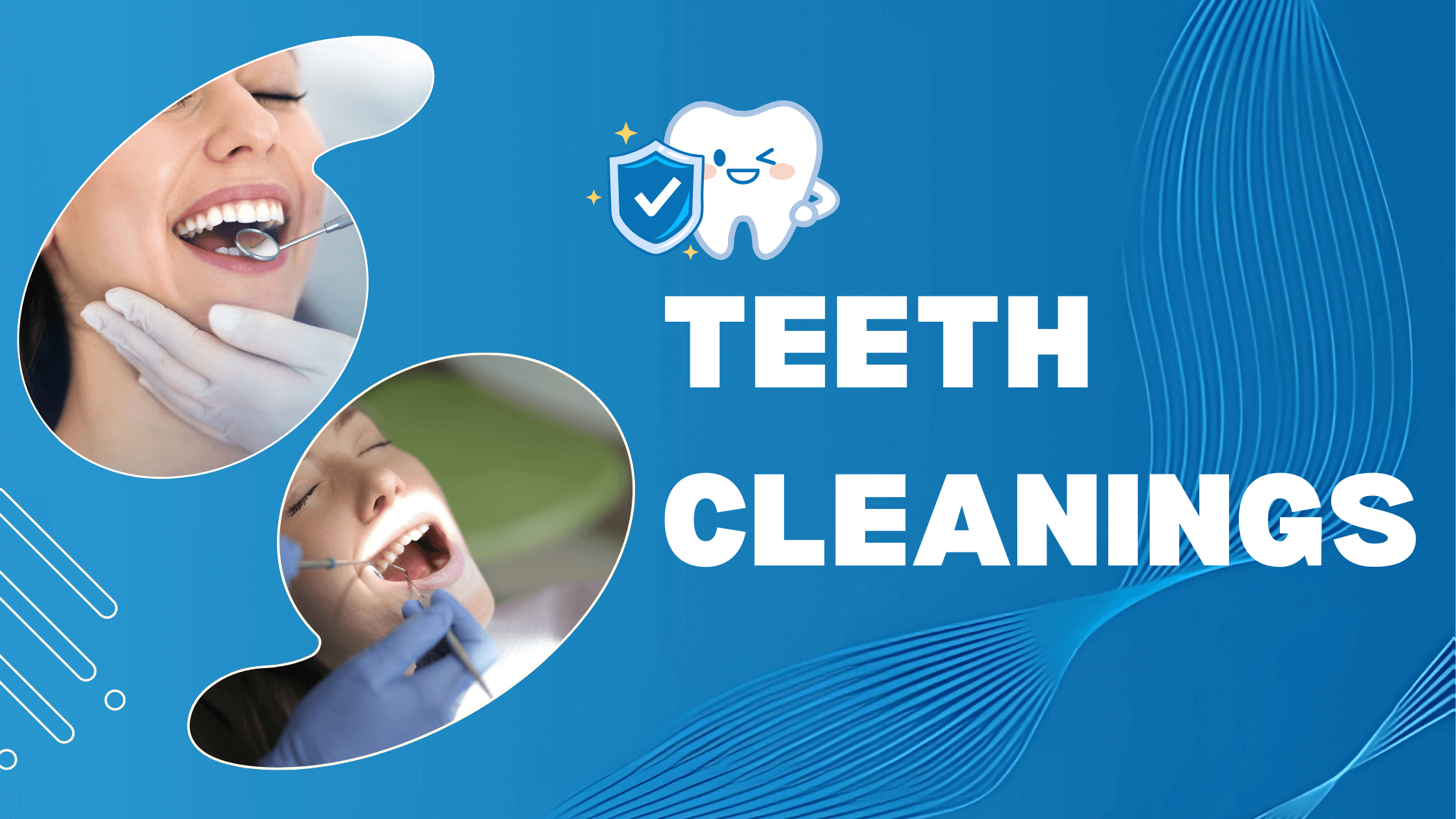 Professional Teeth Cleaning Service in Jaipur at Best Price