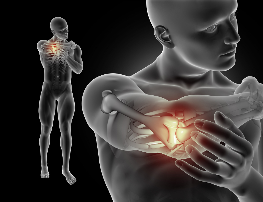 Wrist Sprain Rehab & Chiropractic CT | Kelly Chiro & Rehab