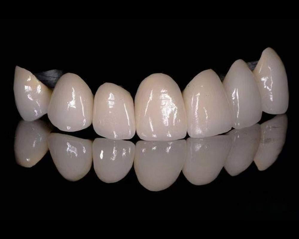PFM Crown Supplier | Trusted Quality and Fast Delivery