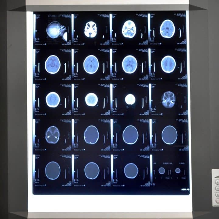 Everything you need know about PUF wall panel company and Led x-ray view box - pdplex.blog