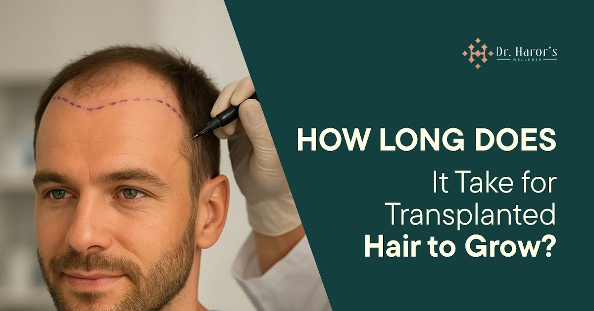 How Long Does It Take for Transplanted Hair to Grow?