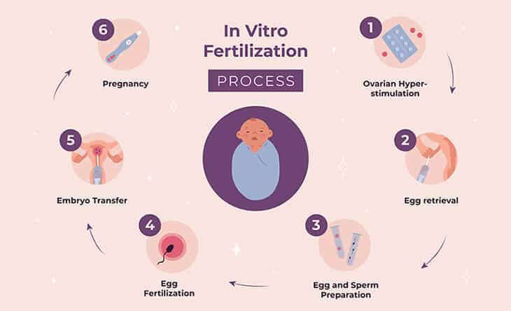 Best IVF Treatment in Delhi | Trusted IVF Centre | Excel IVF