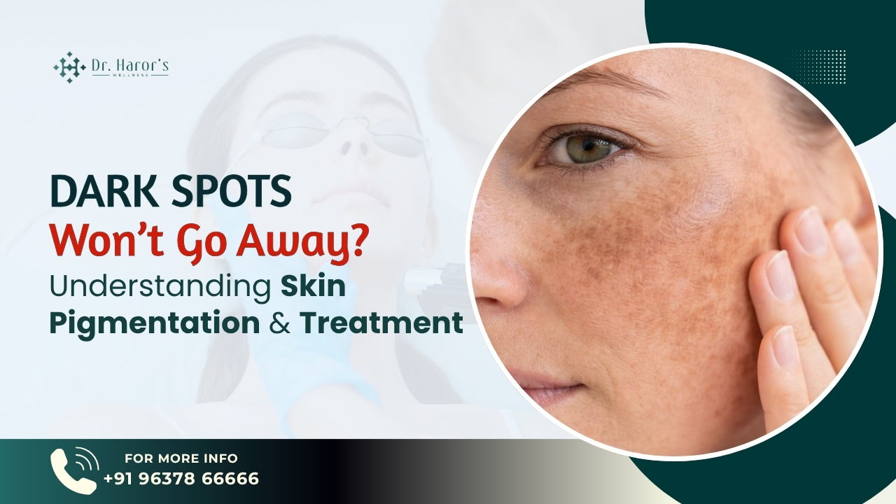 Skin Pigmentation Treatment in Delhi | Dr. Haror’s Wellness