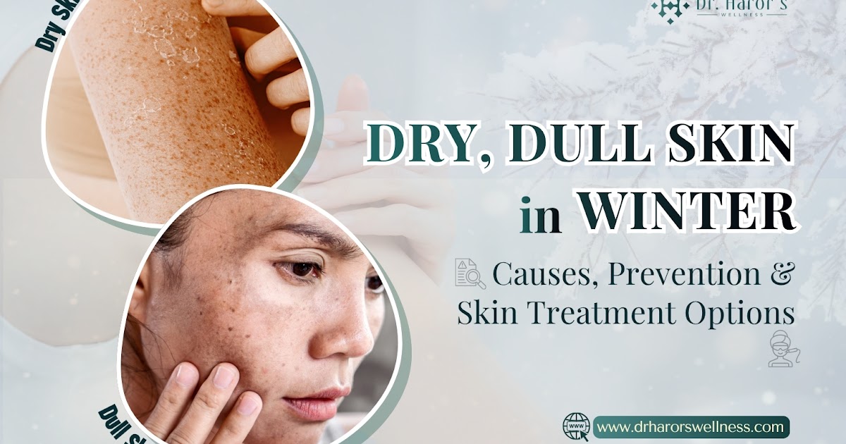 Dry, Dull Skin in Winter: Causes, Prevention & Skin Treatment Options